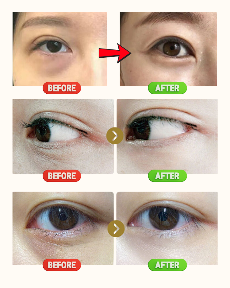 SKIK ESSENTIAL EYE ROLLER
