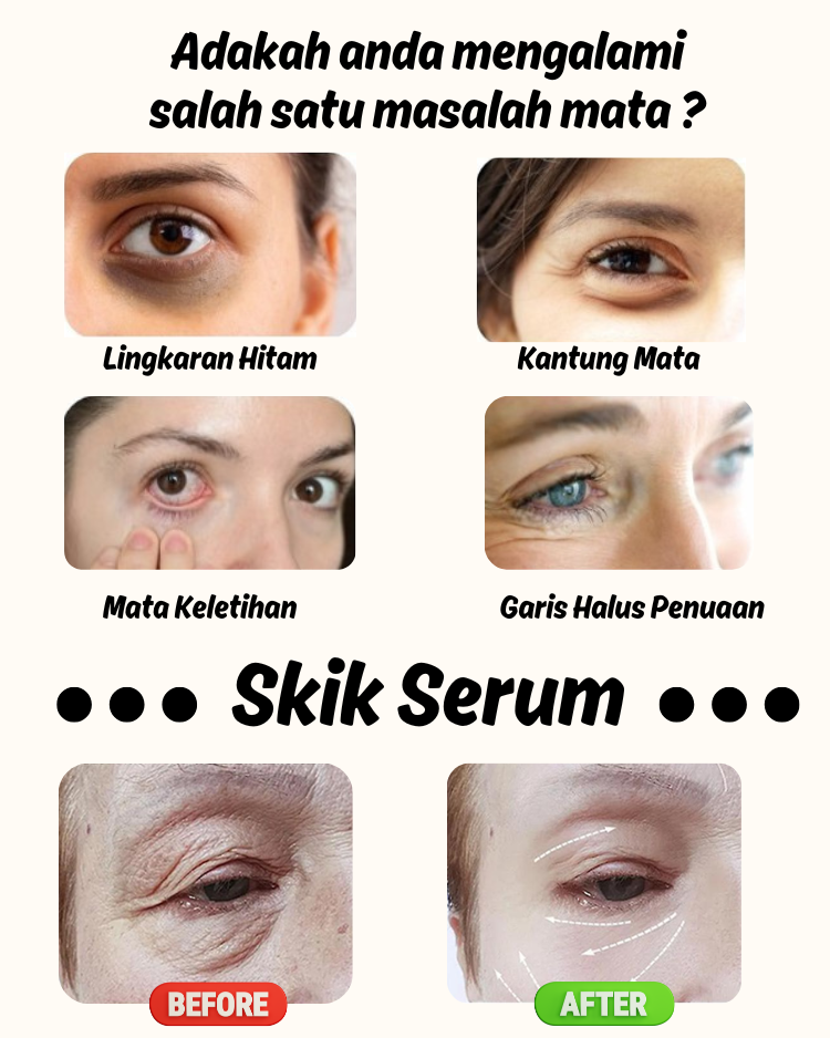 SKIK ESSENTIAL EYE ROLLER